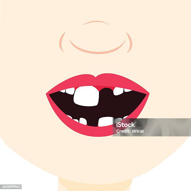 Child With Baby Tooth - Arte vetorial de stock e mais imagens de Criança - Criança, Falha entre os dentes, Dentista