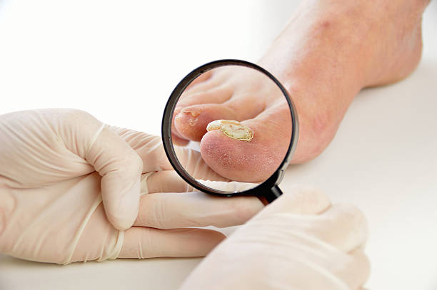 podologist checking the patient foot - on his toes imagens e fotografias de stock