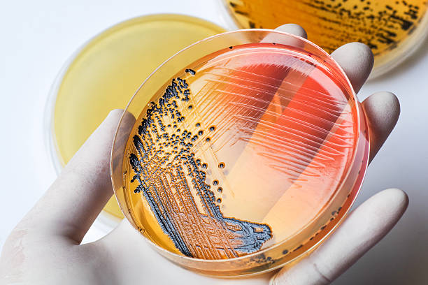 scientist's hand in latex glove holding the bacteria growing pet - bacterium petri dish colony microbiology imagens e fotografias de stock