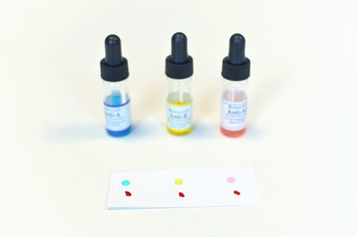 This is agglutination test wich is used to determin blood group, A, AB or B. This is studio shot on white background. This is one of the most important hematologic tests. Blue reagent is used for group A, yellow for AB and red for blood type B. This is tipicaly laboratory test. Blood and reagents on the small sheet of paper.