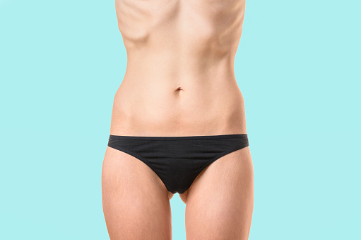 Very thin young woman with protruding bones and ribs suffering from extreme dieting, starvation or an eating disorder such as bulimia or anorexia isolated on white, close up torso shot
