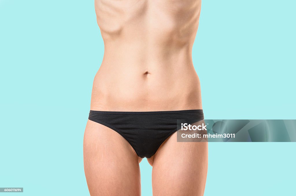 Very thin woman suffering from extreme dieting Very thin young woman with protruding bones and ribs suffering from extreme dieting, starvation or an eating disorder such as bulimia or anorexia isolated on white, close up torso shot Women Stock Photo