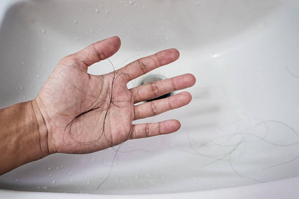 istock Close-up a man hand with loss hair, after taking shower 606209992