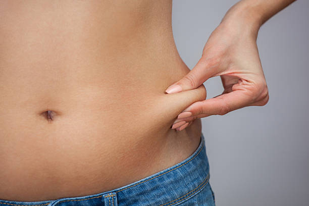 istock She pulls the skin of the abdomen. 607252176