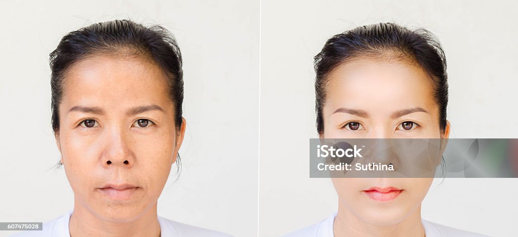 Face of beautiful asian woman before and after retouch Adult Stock Photo