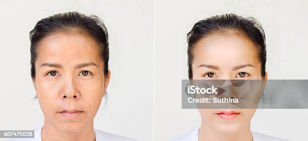 Face Of Beautiful Asian Woman Before And After Retouch Stock Photo - Download Image Now