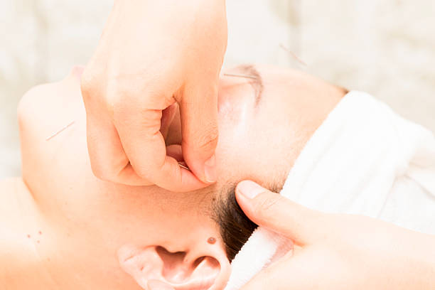 istock Beauty acupuncture to Asian women 607475340
