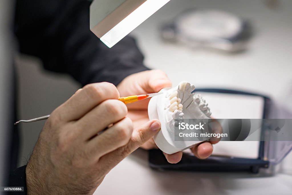 En prothèses dentaires - Photo de Dentisterie esthétique libre de droits