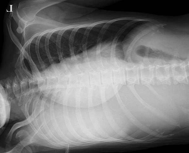 istock Right lateral decubitus chest x-ray 607650634