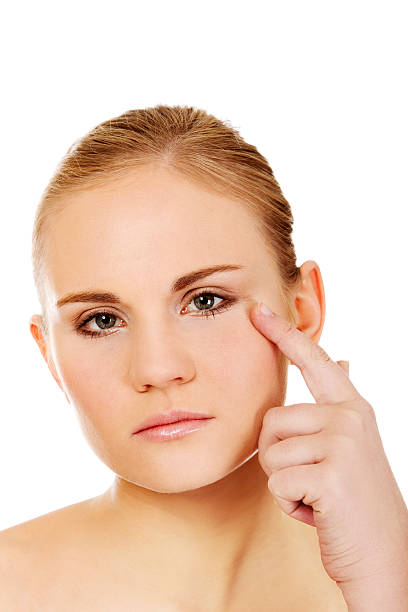 istock Unhappy young woman touching her pimple 607752900