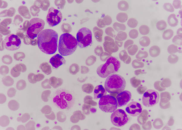 Precursor Cell 80+ Precursor Syndrome Stock Photos, Pictures & Royalty-Free Images ...