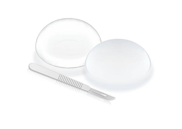 Silicone breast implants and scalpel blade. Silicone breast implants and scalpel blade isolated on white background. This illustration about cosmetic surgery silicon stock illustrations