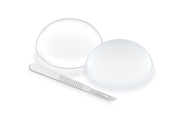 Silicone breast implants and scalpel blade. Silicone breast implants and scalpel blade isolated on white background. This illustration about cosmetic surgery silicone implants stock illustrations