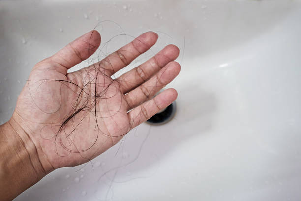 istock Close-up a man hand with loss hair, after taking shower 609436376