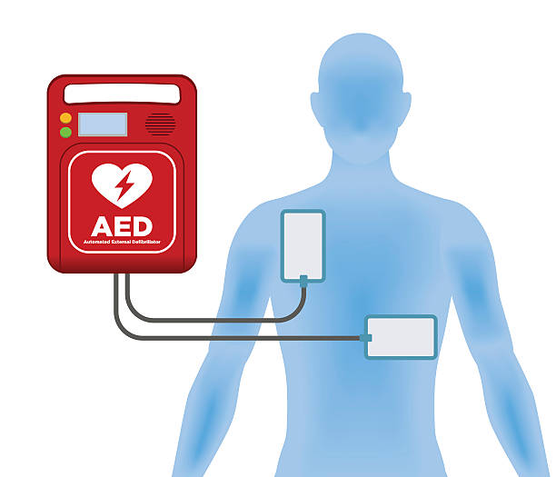 ilustraciones, imágenes clip art, dibujos animados e iconos de stock de aed (desfibrilador externo automatizado), máquina principal y almohadillas de electrodos - fibrillation