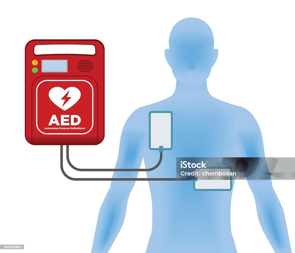 AED(Automated External Defibrillator), main machine and electrode pads Defibrillator stock vector