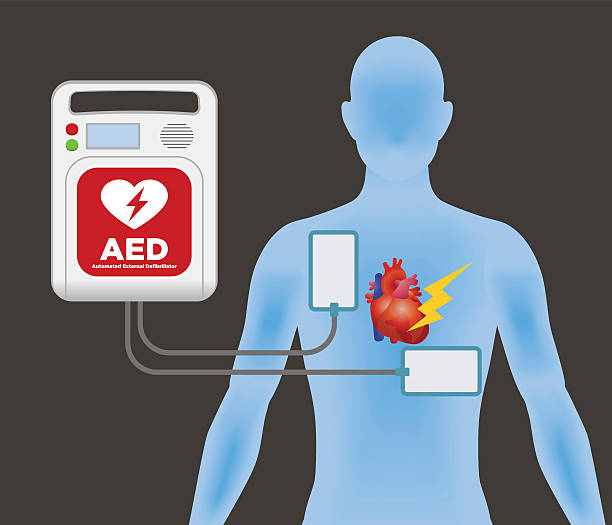 aed (automated external defibrillator), hauptmaschine und elektrodenpads - herzkammer stock-grafiken, -clipart, -cartoons und -symbole