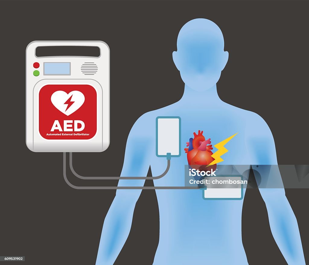 Aed Example Machine Aed Main Machine And Electrode Pads Stock Illustration - Download Image ...