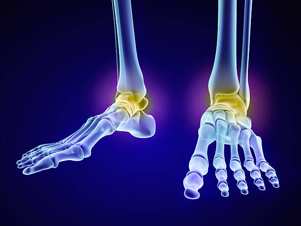 Skeletal foot - injuryd talus bone. Xray view. Skeletal foot - injuryd talus bone. Xray view. Medically accurate 3D illustration x ray tarsal ankle and foot stock pictures, royalty-free photos & images