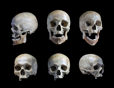 A model of a human skull.