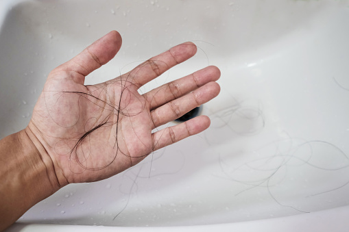 Close-up a man hand with loss hair, after taking shower, on lavatory, concepts of hair diffused
