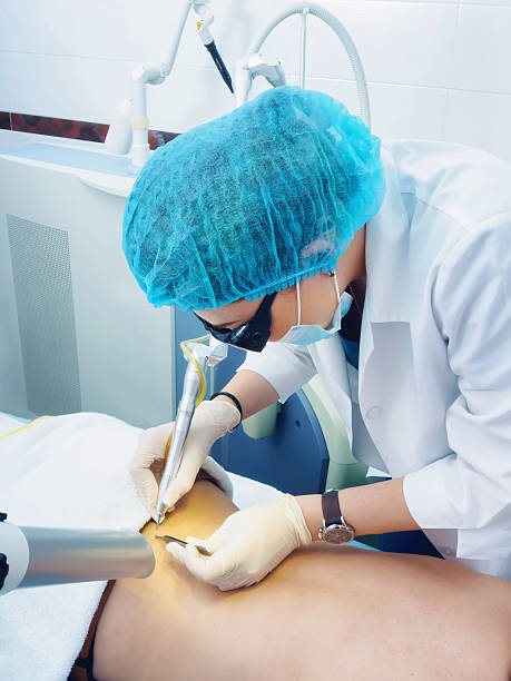 istock Laser treatment. Doctor making procedure skin nevus removal. 610143846