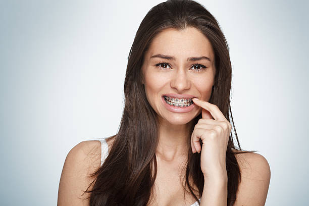 Face of a young woman with braces on her teeth stock photo