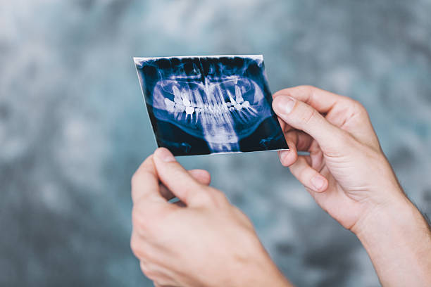 istock Doctor holding and looking at dental x-ray 610433082