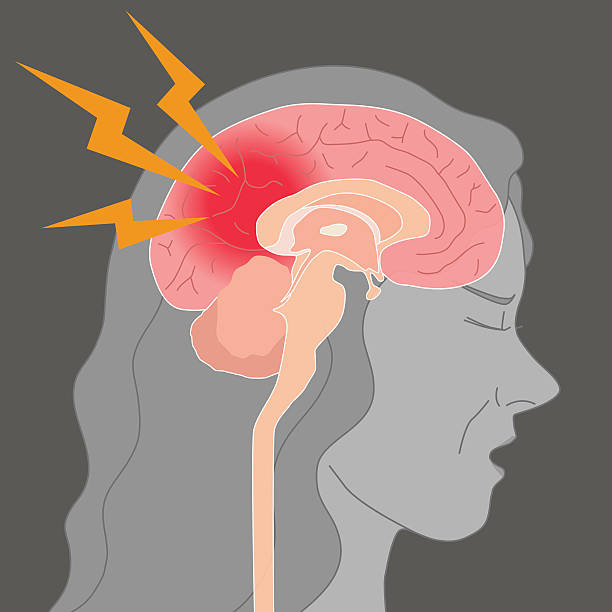 노인 두통, 뇌 출혈, 뇌 뇌졸중, 벡터 일러스트 - medulla oblongata stock illustrations