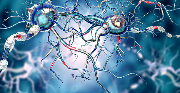 betroffene nervenzellen, konzept für neurologische erkrankungen, tumoren, hirnchirurgie. - scandic stock-fotos und bilder