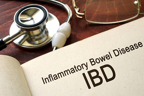 Book with words inflammatory bowel disease IBD on a table. Book with words inflammatory bowel disease IBD on a table. gastroenterology photos stock pictures, royalty-free photos & images
