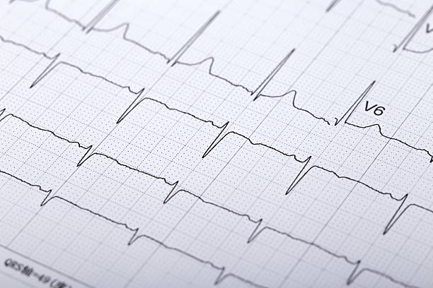 electrocardiogram stock photo