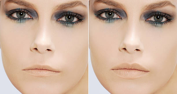 istock woman fill lips - before and after 610748114