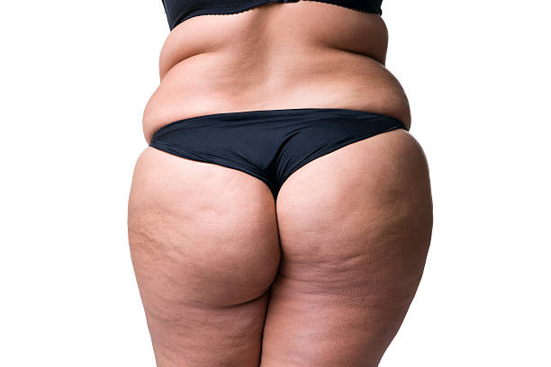 fat female body with cellulite, fatty hips and buttocks - dieting overweight weight scale healthcare and medicine imagens e fotografias de stock