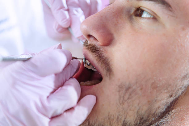 istock Man with braces at dentist 611080766