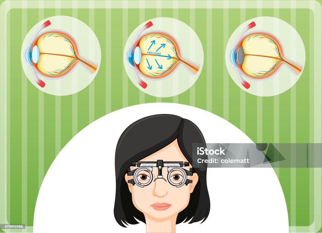 Eye Problem Picture Examples Eye Problem In Human Body Stock Illustration - Download Image Now ...