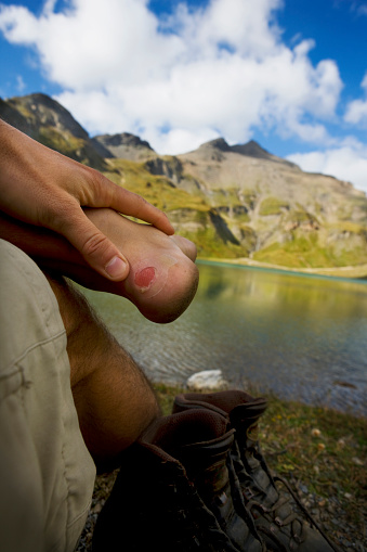 Close up of the heel of a young man with a blister from hiking up a mountain. Resting at a mountain lake in a scenic landscape. Transparent plaster applied. XXXL (Canon Eos 1Ds Mark III)