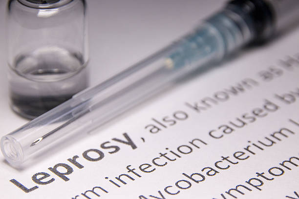 Leprosy Leprosy (Hansen's disease) vaccine under research. leprosy stock pictures, royalty-free photos & images