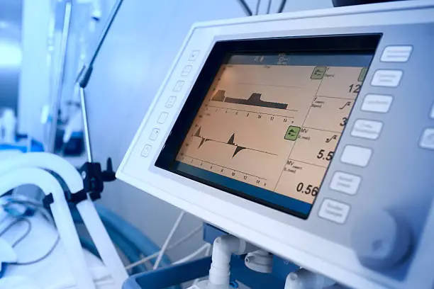 Monitoring of mechanically ventilated patient in hospital