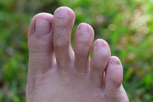 closeup Asain lady toes