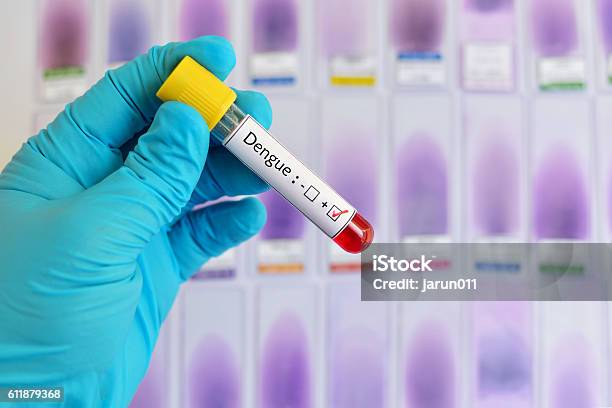 Dengue Positive Stock Photo - Download Image Now - Aedes Mosquito, Biology, Biotechnology