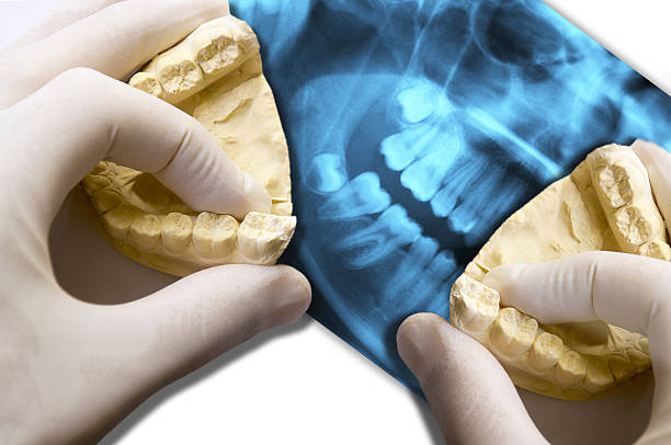 dentist hands show molars teeth over x-ray dental scan