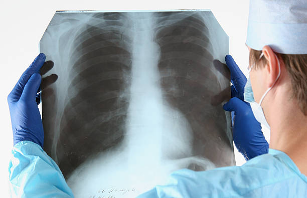 istock Doctor in blue uniform holding X-rays 612262148