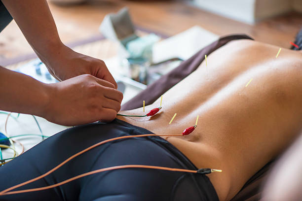 istock Young woman at the acupuncture treatment 612501664