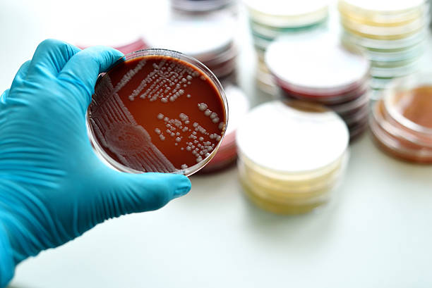 bactéria cultura - petri dish bacterium microbiology streptococcus - fotografias e filmes do acervo