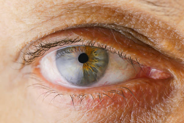 istock Close up old women green eye 612514094