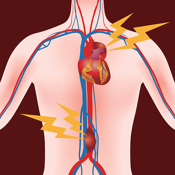 аневризма брюшной аорты и аневризма торакальной аорты - human cardiovascular system blood flow human vein body stock illustrations