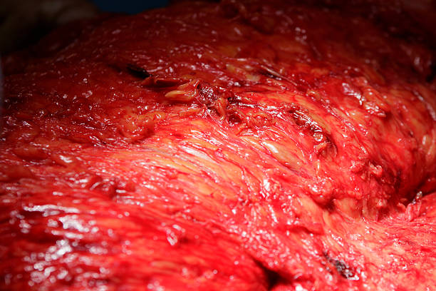 istock Human Flesh Surgery Background 612729926