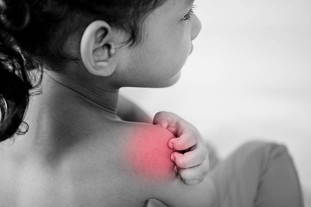 istock Health problem. asian young girl scratching her itchy shoulder 612851668