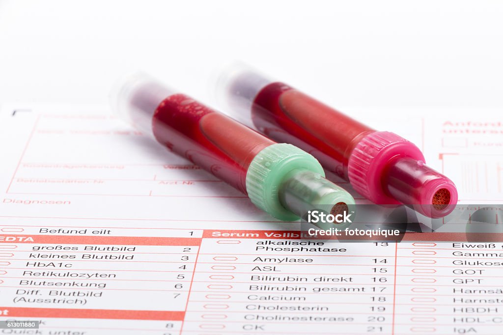 Blood In Lab Blood Test Blood Samples On A Laboratory Form Stock Photo - Download ...